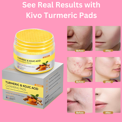 Kivo Turmeric Pads