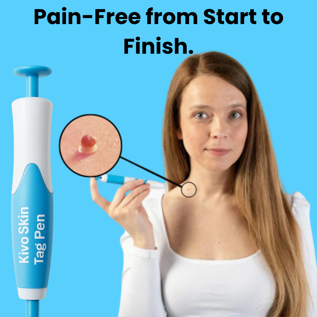 Kivo Skin Tag Pen