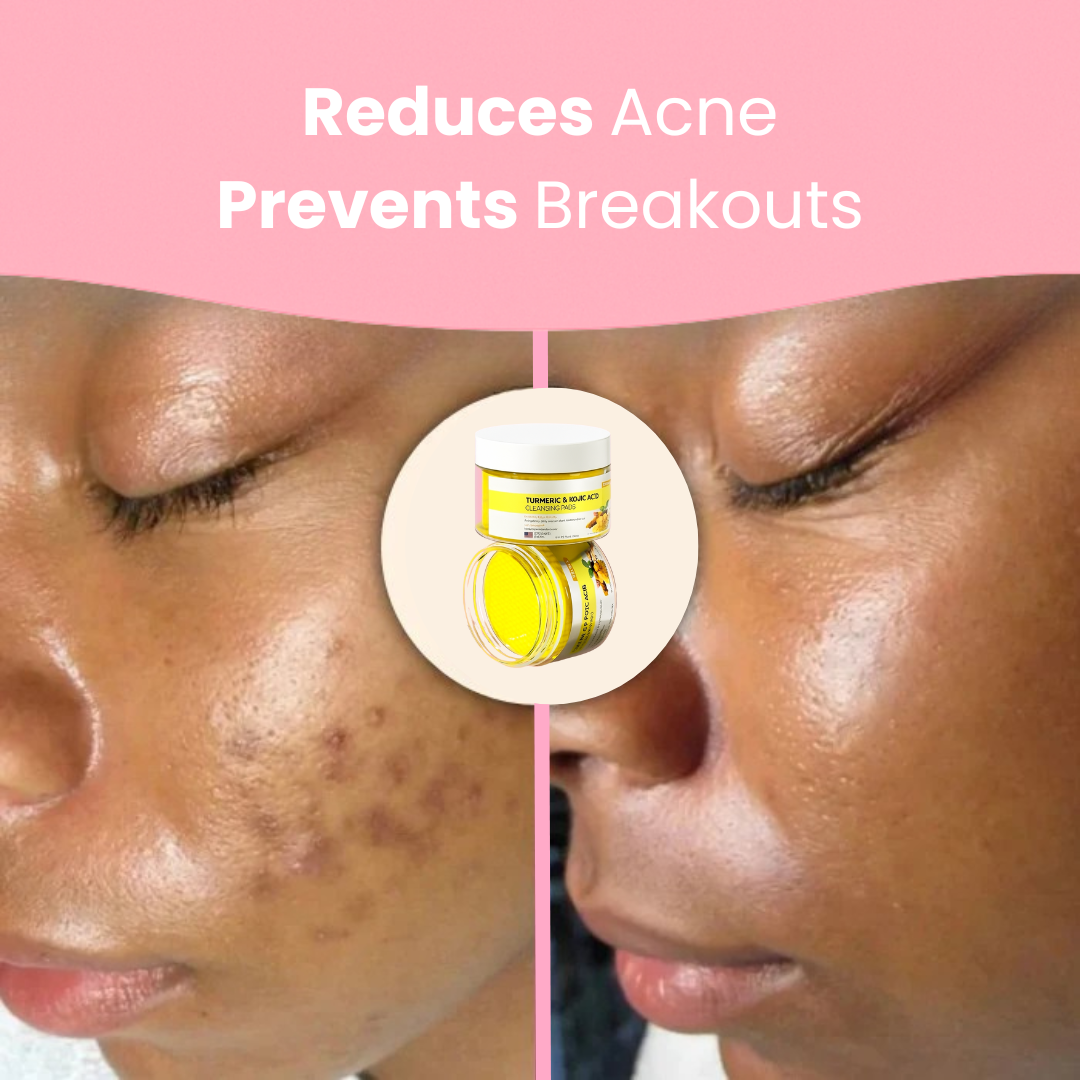 Kivo Turmeric Pads